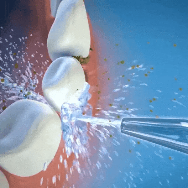 HYDROPULSEUR JET DENTAIRE PORTABLE 2.0